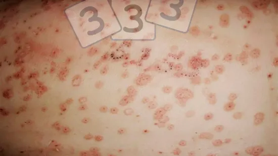 Tydzień 18-lis-2025